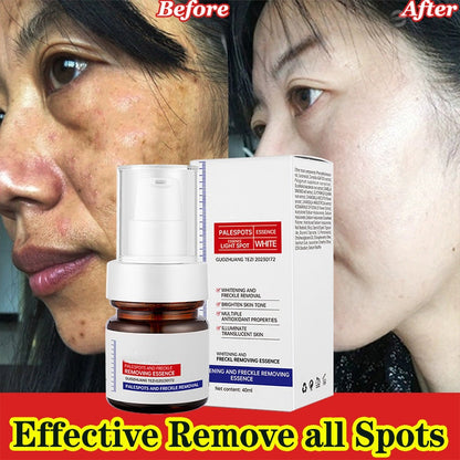Vitamin C Whitening Freckles ESSENCE：Dark spots disappear, blemishes fade, and skin becomes radiant!